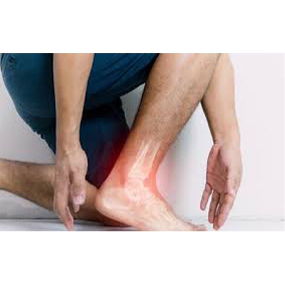 Anterior Ankle Impingement Syndrome (Sindromul de impingement anterior al gleznei)