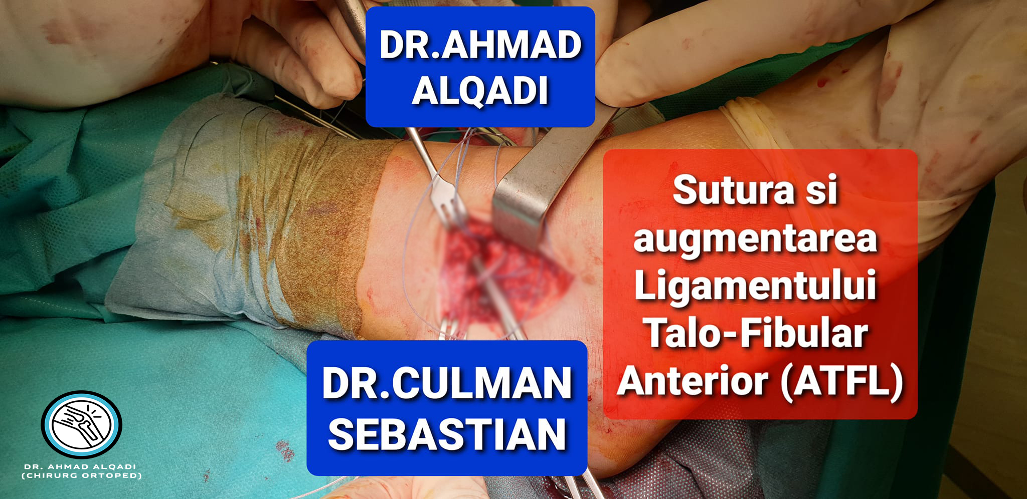 artroscopie-de-glezna-si-reconstructia-ATFL-Ligamentul-Talo-Fibular-Anterior-pe-cale-deschisa-CU-SIGLA-1