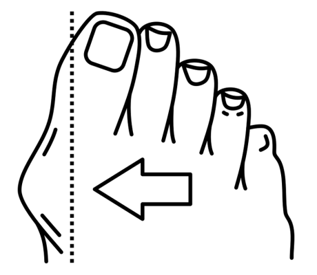 noun-hallux-valgus-3819546